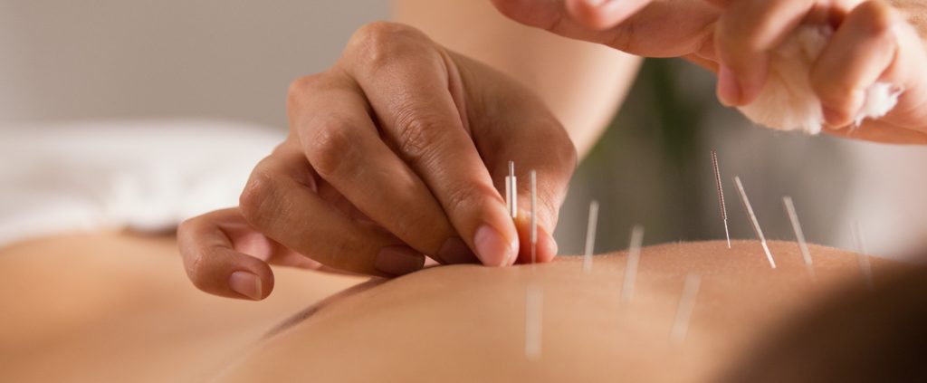 Acupuncture to Battle the Cold and Flu Season